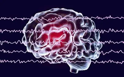 image of CCN Seminar series - Brain Rhythms and Health: Predicting Pain, Dementia, and inflammation through EEG