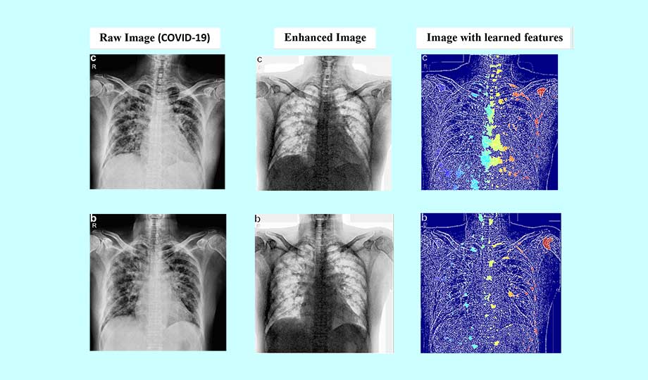 AI Auto Scans Lung X Rays For Coronavirus Brunel University London