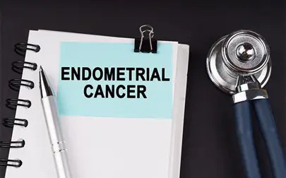 image of New endometrial cancer study highlights overlooked risk factors