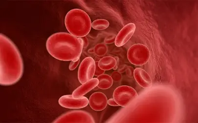 image of Sickle cell disease is a genetic disorder that causes lifelong suffering – here's what you need to know