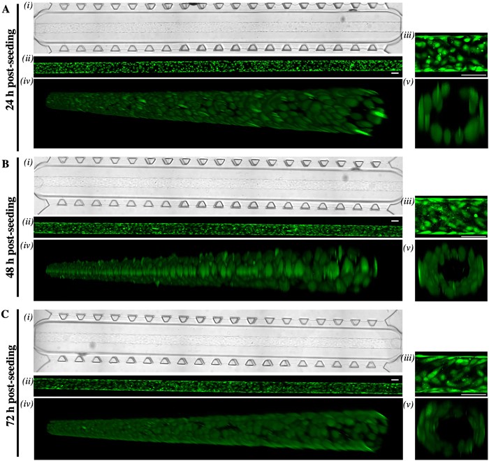 Images of endothelial cells growing in the 3D organ-on-a-chip device used in Dr Cerutti’s lab