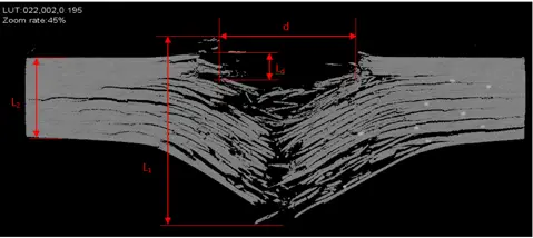 XCT Scan