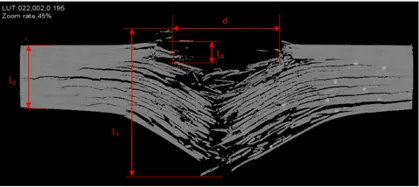 XCT Scan